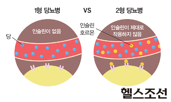 image.png 당신의 몸이 ㅈ되고 있다는 신호 - 당뇨병