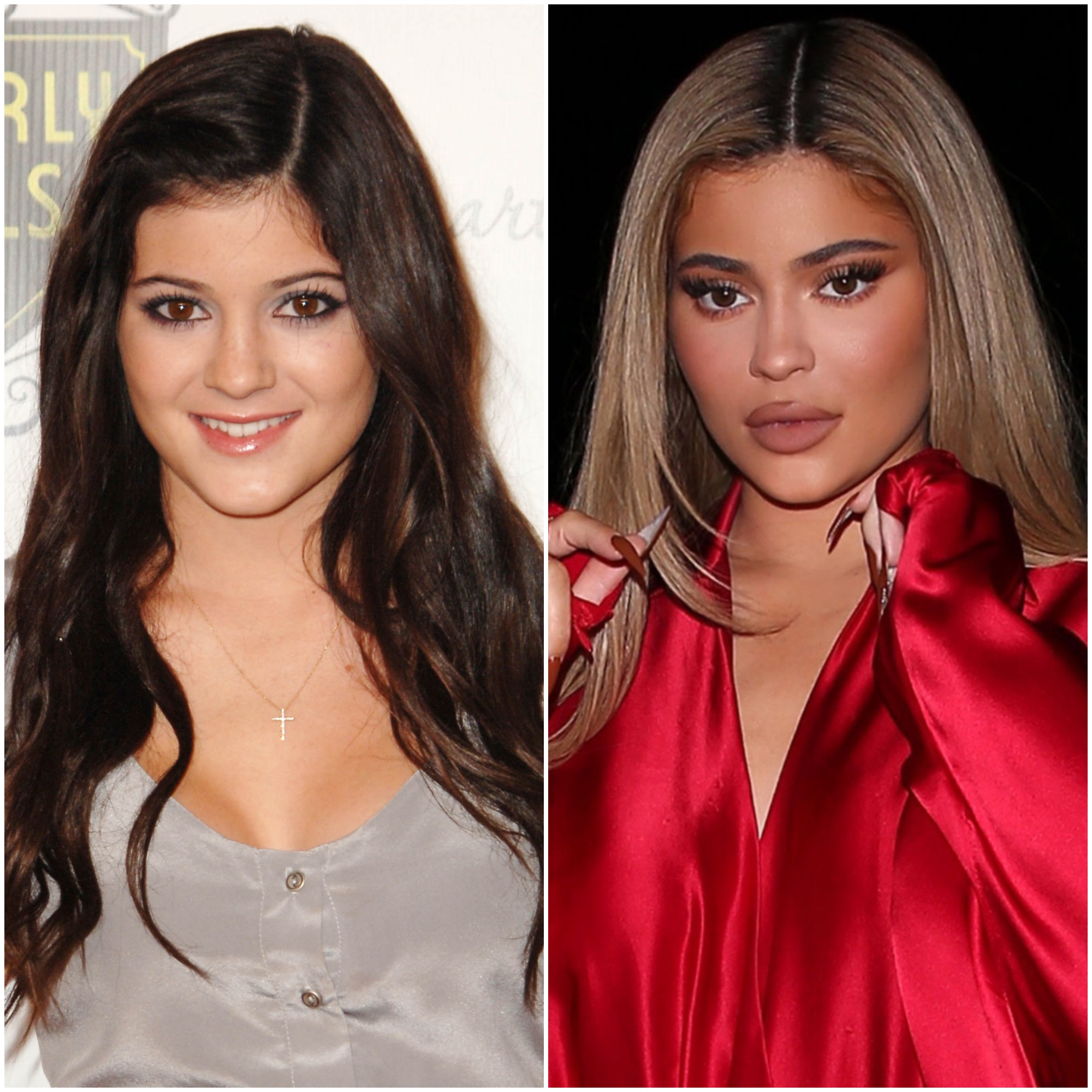 Kylie-Jenner-Plastic-Surgery.jpeg