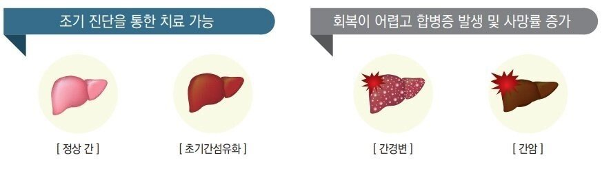 1.jpg 담배와 간의 상관관계