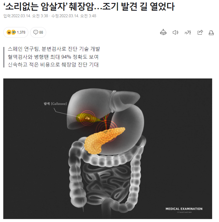 image.png ‘소리없는 암살자’ 췌장암…조기 발견 길 열었다