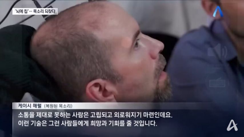 뇌 임플란트 실험 결과 근황6.jpg