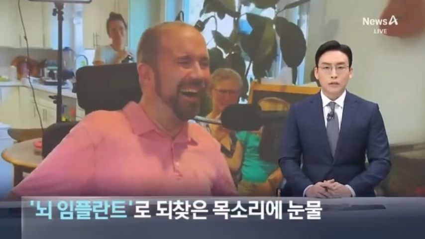 뇌 임플란트 실험 결과 근황.jpg