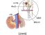음식을 마음놓고 먹을 수 없게 만드는 신장질환